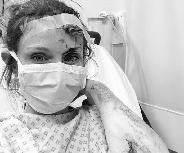 Sophie Ellis-Bextor after crash
